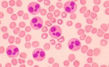 How Cutting-Edge Medical Devices Can Detect Sepsis Earlier