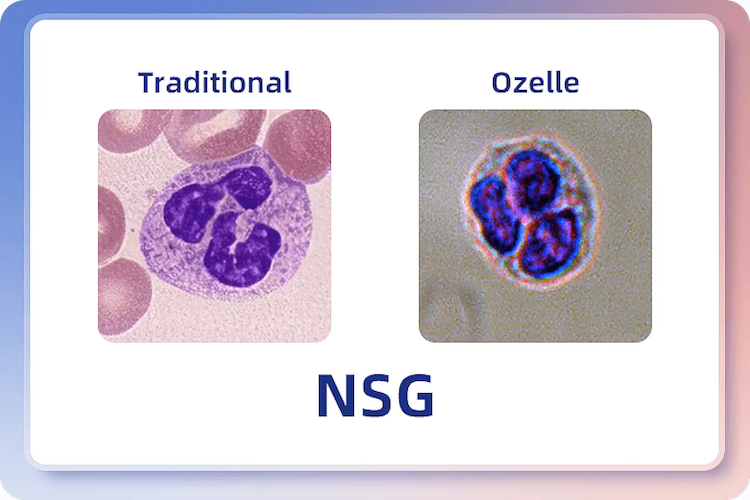 Imagiologia de citologia líquida de alta resolução